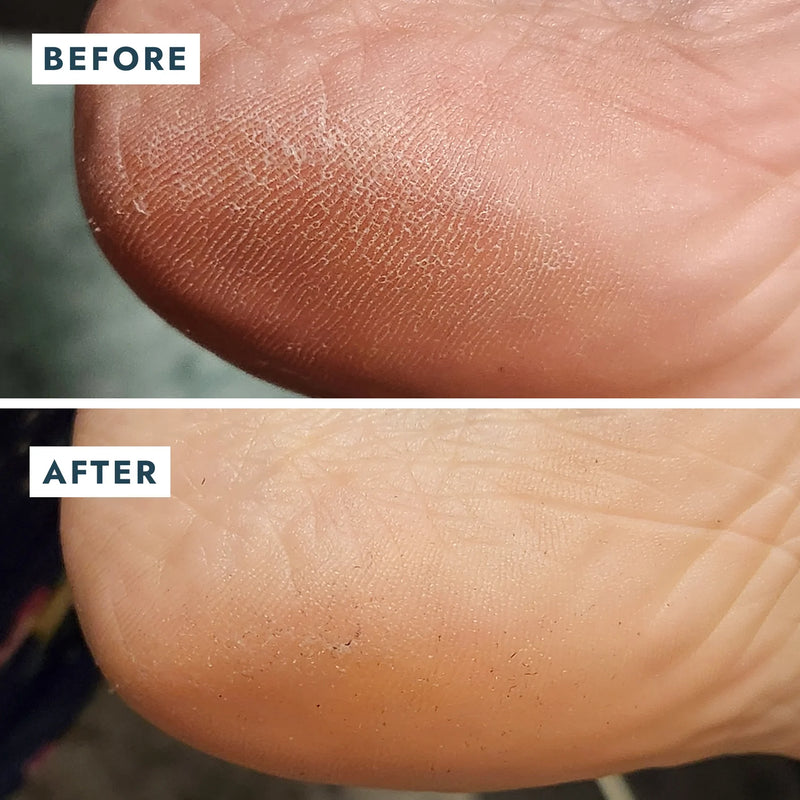 VOESH - HEEL REPAIR DUO (HEEL REPAIR BALM + HEEL SOCKS)