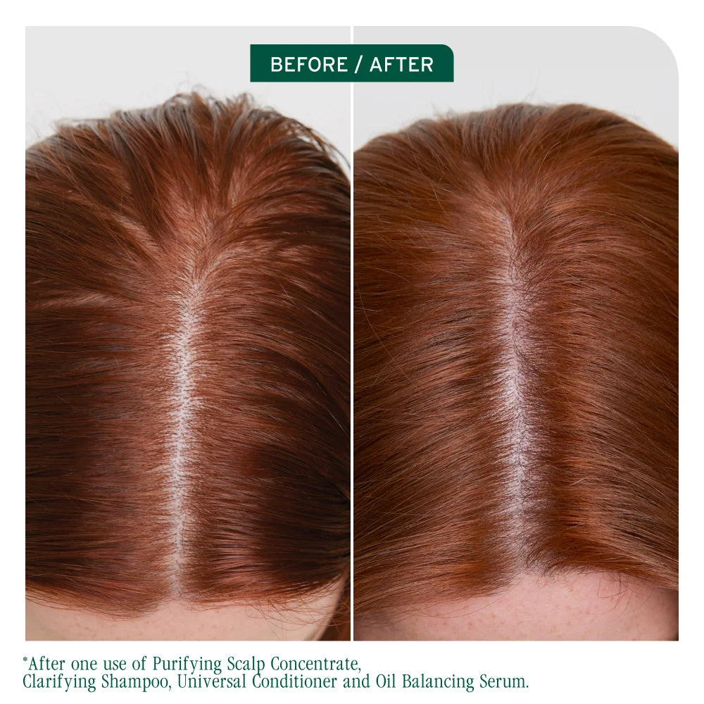 Biolage-2025-Scalp-Sync-