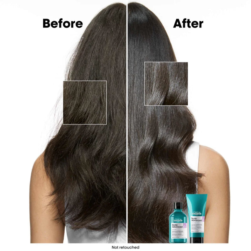 SERIE EXPERT Scalp Advanced Anti-discomfort Shampoo