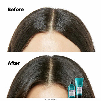 SERIE EXPERT Scalp Advanced Anti-discomfort Shampoo